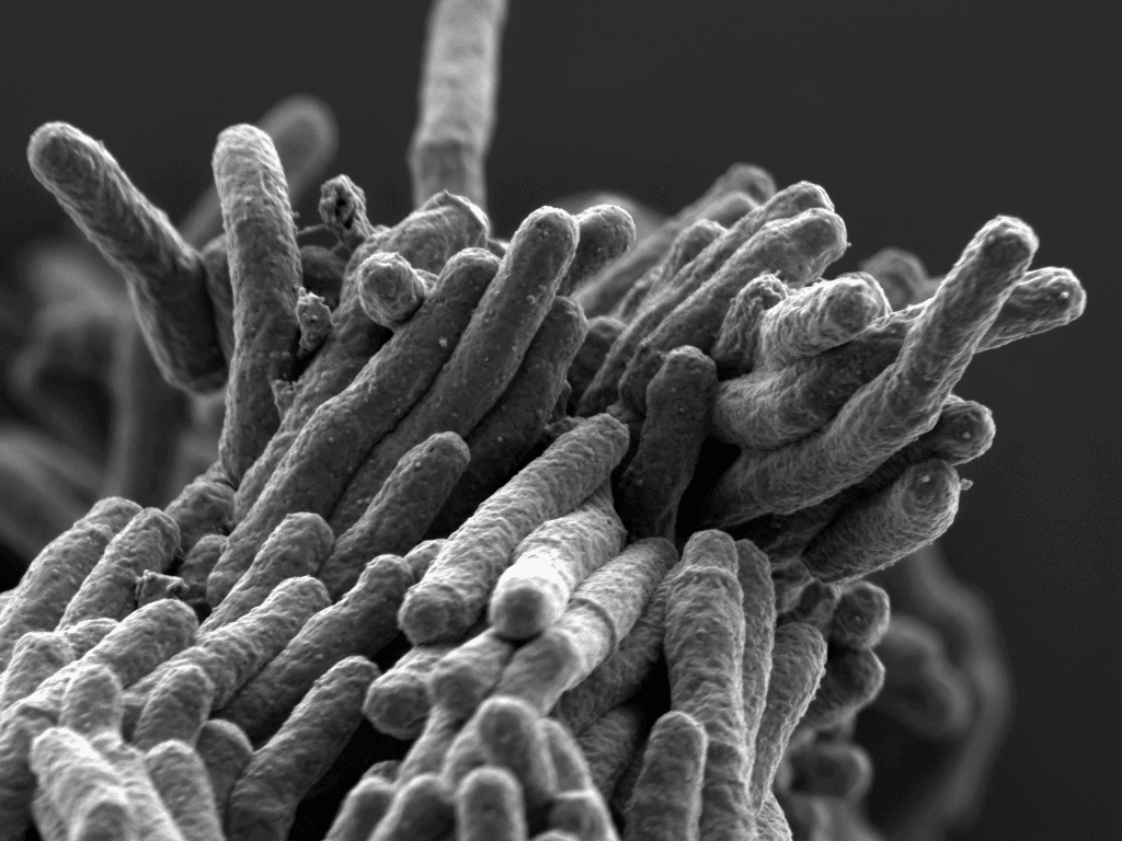 Как выглядит палочка коха под микроскопом фото