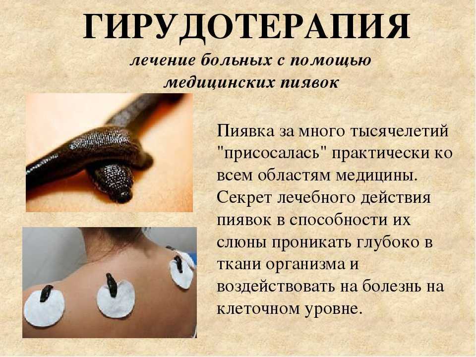 Пиявка медицинская: особенности и интересные факты